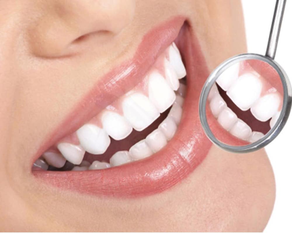 imagen de estetica dental clinica moratalaz 66